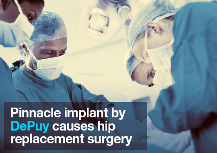 Pinnacle implant by Depuy causes hip replacement surgery